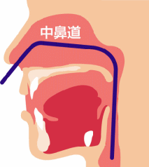 鼻からの内視鏡検査